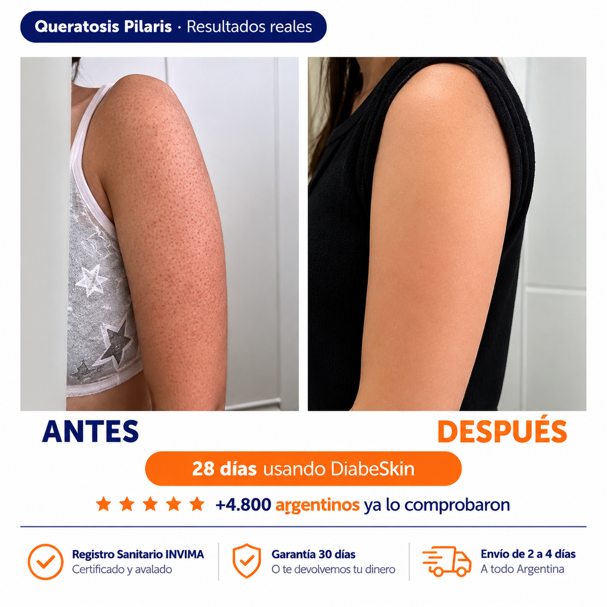 Adiós a la piel reseca, áspera y con picazón