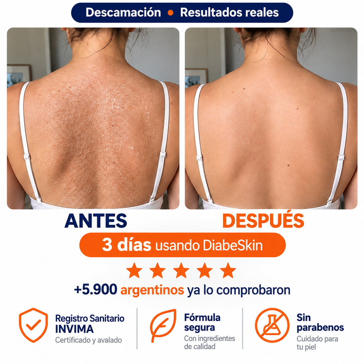 Adiós a la piel reseca, áspera y con picazón