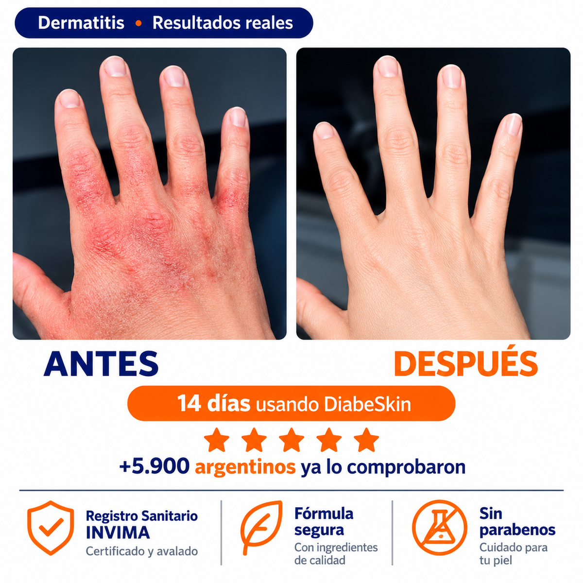 Adiós a la piel reseca, áspera y con picazón