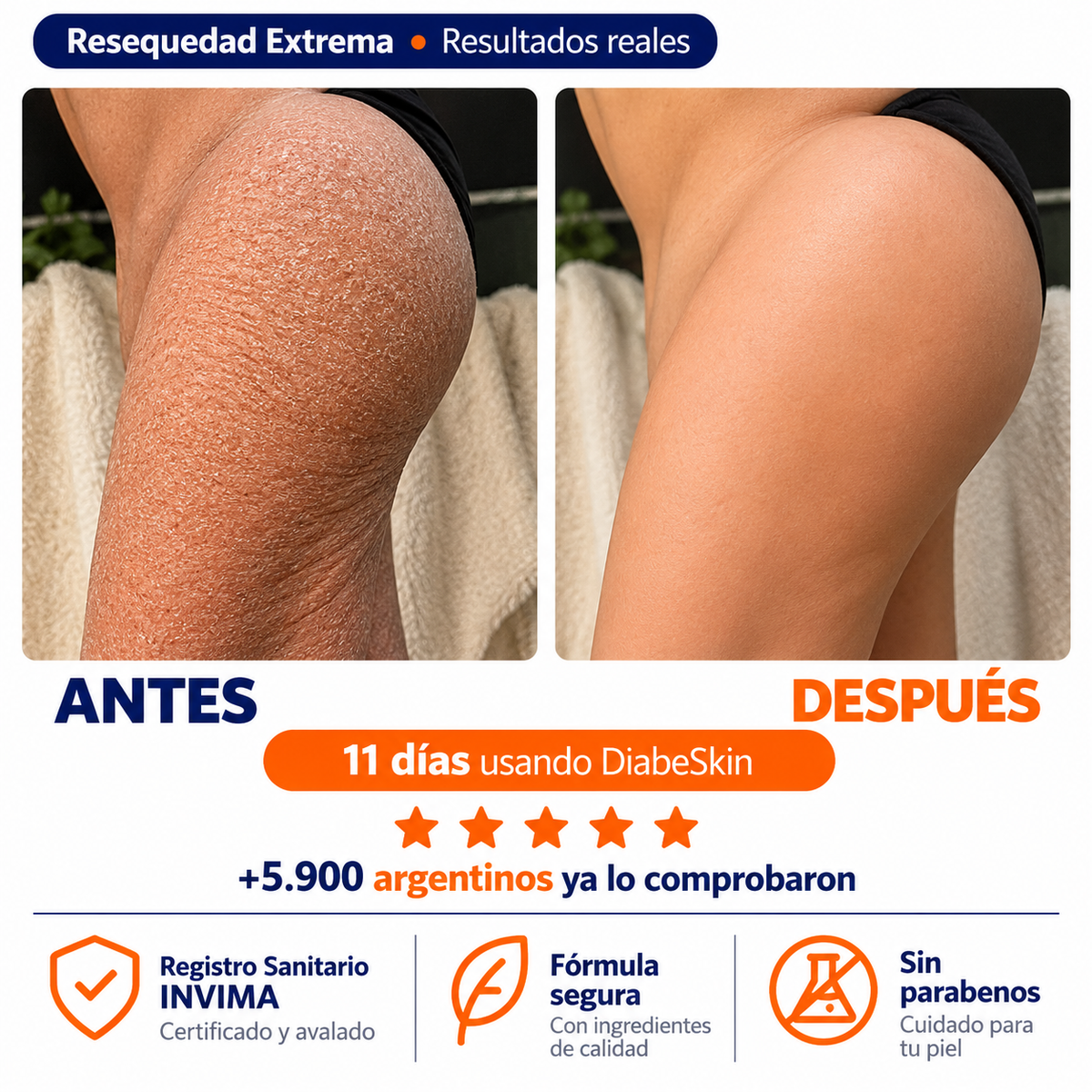 Adiós a la piel reseca, áspera y con picazón